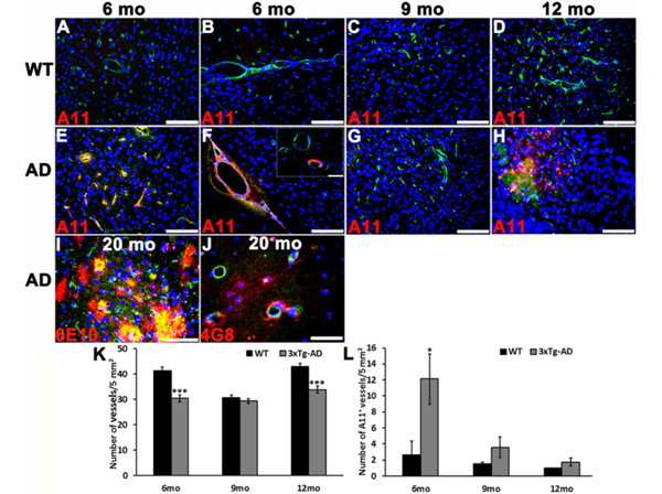 Immunofluorescence using Aβ40 oligomers